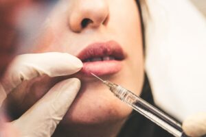 Bezbolestné zväčšenie pier: 7 vecí, na ktoré nesmiete zabúdať