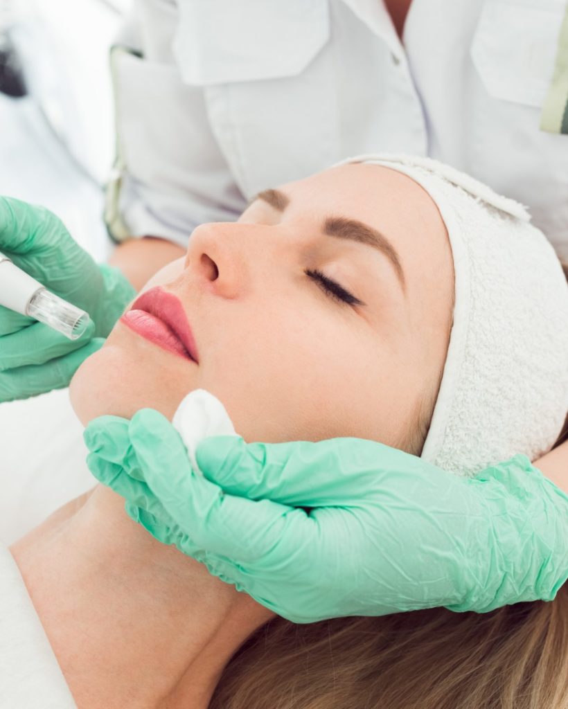 Microneedling